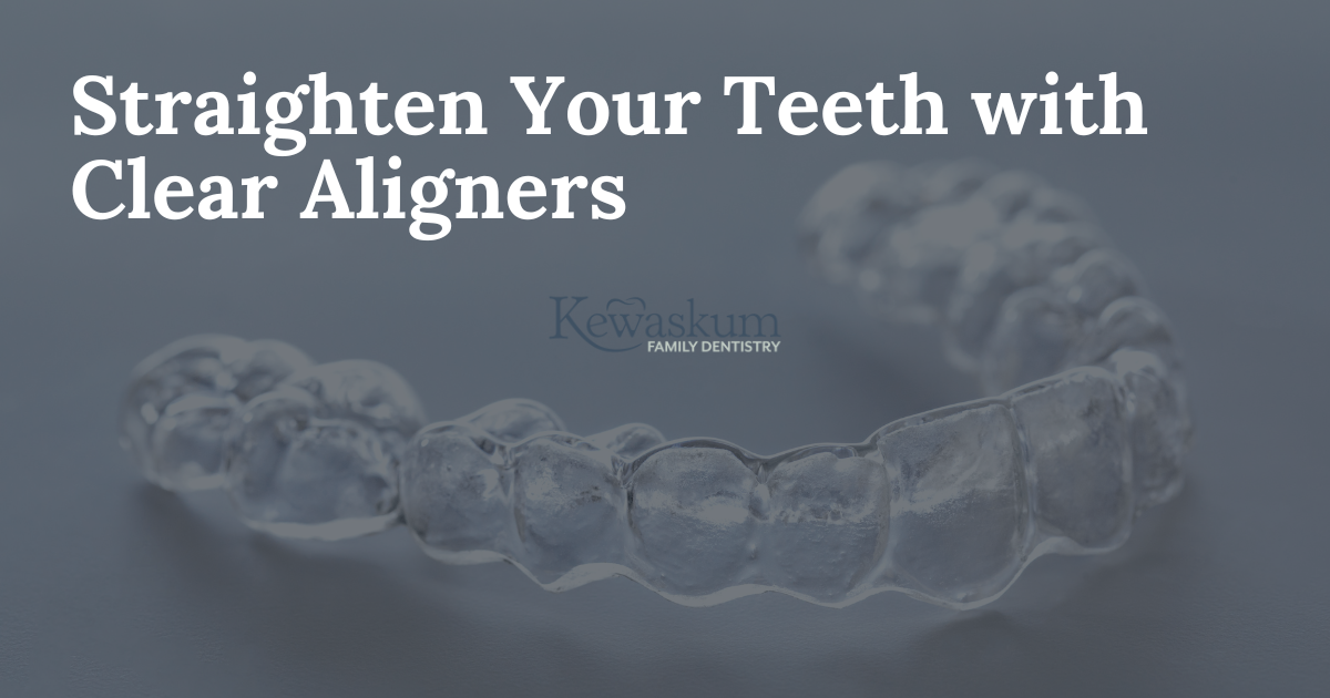 Clear Aligners - Kewaskum Family Dentistry